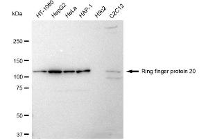 anti-Ring Finger Protein 20 (RNF20) antibody