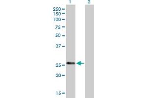 Western Blot analysis of KLK7 expression in transfected 293T cell line by KLK7 MaxPab polyclonal antibody. (Kallikrein 7 抗体  (AA 1-253))
