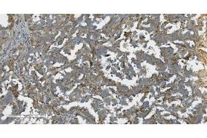 IHC analysis of K Cadherin/CDH6 using anti-K Cadherin/CDH6 antibody (ABIN7600136). (CDH6 抗体  (AA 153-424))