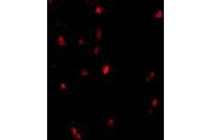 Immunofluorescence of cbl in human lymph node tissue with AP30209PU-N cbl antibody at 20 μg/ml. (CBL 抗体  (C-Term))