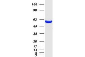 Western Blotting (WB) image for Coronin, Actin Binding Protein, 1A (CORO1A) protein (Myc-DYKDDDDK Tag) (ABIN2712511)