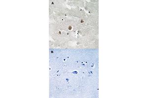 Immunohistochemical staining of human brain tissue by MAP3K1 (phospho T1400) polyclonal antibody  without blocking peptide (A) or preincubated with blocking peptide (B).