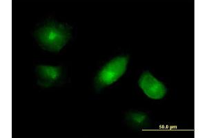 Immunofluorescence of purified MaxPab antibody to VAC14 on HeLa cell. (VAC14 抗体  (AA 1-782))