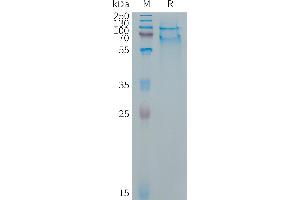 Cynomolgus SELPLG Protein, His Tag on SDS-PAGE under reducing condition.