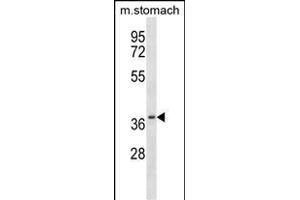 Western Blotting (WB) image for anti-Casein Kinase 2, alpha Prime Polypeptide (CSNK2A2) (AA 4-32), (N-Term) antibody (ABIN657725)