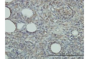 Immunoperoxidase of monoclonal antibody to PRDX2 on formalin-fixed paraffin-embedded human malignant lymphoma, diffuse large B tissue. (Peroxiredoxin 2 抗体  (AA 1-198))