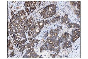 IHC analysis of AS160/TBC1D4 using anti-AS160/TBC1D4 antibody (ABIN7599745). (TBC1D4 抗体  (AA 1118-1298))