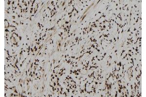 ABIN6273104 at 1/100 staining Human gastric tissue by IHC-P. (CPSF4 抗体  (C-Term))