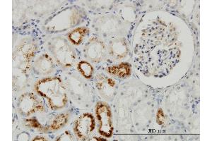 Immunoperoxidase of monoclonal antibody to TIMP2 on formalin-fixed paraffin-embedded human kidney. (TIMP2 抗体  (AA 27-220))