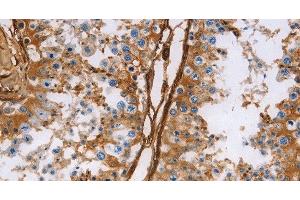 Immunohistochemistry of paraffin-embedded Human testis using Caldesmon Polyclonal Antibody at dilution of 1:40 (Caldesmon 抗体)