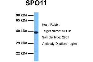 Host: Rabbit Target Name: SPO11 Sample Tissue: Human 293T Antibody Dilution: 1. (SPO11 抗体  (N-Term))