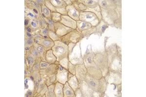 Immunohistochemistry of paraffin-embedded human esophageal using IL7R antibody at dilution of 1:100 (40x lens). (IL7R 抗体)