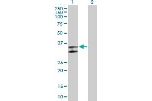 Western Blot analysis of SERPINC1 expression in transfected 293T cell line by SERPINC1 MaxPab polyclonal antibody. (SERPINC1 抗体  (AA 1-259))