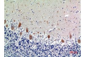 Immunohistochemical analysis of paraffin-embedded human-brain, antibody was diluted at 1:100 (KIR3DL1 抗体  (N-Term))