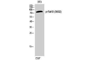Western Blotting (WB) image for anti-B-Raf proto-oncogene, serine/threonine kinase (BRAF) (pSer602) antibody (ABIN3173267) (BRAF 抗体  (pSer602))