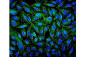 IF analysis of Tubulin beta using anti-Tubulin beta antibody (ABIN7602744).