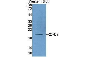 Western Blotting (WB) image for anti-Matrix Metallopeptidase 9 (Gelatinase B, 92kDa Gelatinase, 92kDa Type IV Collagenase) (MMP9) antibody (FITC) (ABIN1173111) (MMP 9 抗体  (FITC))