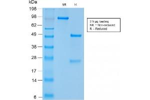 SDS-PAGE Analysis Purified CD56 Rabbit Recombinant Monoclonal Antibody (NCAM1/2217R). (Recombinant CD56 抗体)