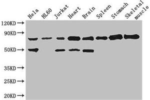 Western Blot Positive WB detected in: Hela whole cell lysate, HL60 whole cell lysate, Jurkat whole cell lysate, Mouse heart tissue, Mouse brain tissue, Mouse spleen tissue, Mouse stomach tissue, Mouse skeletal muscle tissue All lanes: SENP1 antibody at 2. (SENP1 抗体  (AA 63-214))