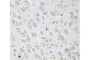 Immunohistochemistry of paraffin-embedded Rat brain using RPN2 Polyclonal Antibody at dilution of 1:100 (40x lens). (Ribophorin II 抗体)