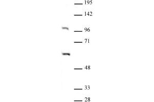 PAF1 antibody (pAb) tested by Western blot. (PAF1/PD2 抗体)