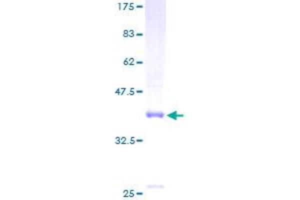 Neuromedin B Protein (GST tag)