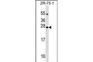 Western blot analysis in ZR-75-1 cell line lysates (35ug/lane). (NXNL1 抗体  (AA 94-121))