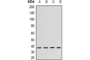 Western blot analysis of CK2 alpha expression in K562 (A), Hela (B), mouse testis (C), mouse brain (D) whole cell lysates. (CSNK2A1/CK II alpha 抗体)