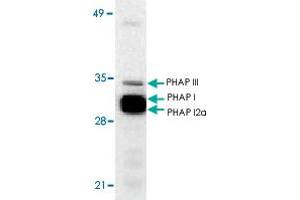 Western blot analysis of ANP32A expression in human Raji cell lysate with ANP32A polyclonal antibody  at 1 ug/mL . (PHAP1 抗体  (N-Term))