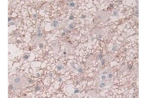 Immunohistochemistry (IHC) image for anti-Plasminogen Activator Inhibitor 1 (SERPINE1) antibody (ABIN7427915)