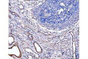IHC analysis of MT-ND5 using anti-MT-ND5 antibody (ABIN7600145).