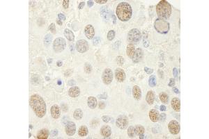 Immunohistochemistry (IHC) image for anti-Nuclear Transcription Factor Y, gamma (NFYC) (AA 408-458) antibody (ABIN7448691)