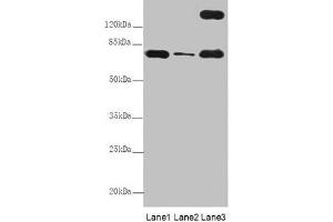 Western Blot All lanes: TTC12 antibody at 8 μg/mL Lane 1: Mouse large intestine tissue Lane 2: Mouse small intestine tissue Lane 3: HepG2 whole cell lysate Secondary Goat polyclonal to rabbit IgG at 1/10000 dilution Predicted band size: 79, 82 kDa Observed band size: 79, 170 kDa (TTC12 抗体  (AA 1-260))