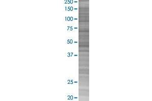 HDAC3 transfected lysate. (HDAC3 293T Cell Transient Overexpression Lysate(Denatured))