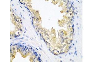 Immunohistochemistry of paraffin-embedded Human prostate using SPINT2 Polyclonal Antibody at dilution of 1:200 (40x lens). (SPINT2 抗体)