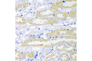 Immunohistochemistry of paraffin-embedded mouse kidney using FABP6 antibody (ABIN5974154) at dilution of 1/200 (40x lens). (FABP6 抗体)