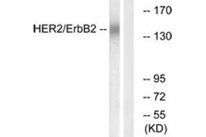 Western blot analysis of extracts from HuvEc cells, using HER2 (Ab-686) Antibody. (ErbB2/Her2 抗体  (AA 661-710))
