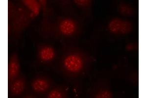 Immunofluorescence staining of methanol-fixed MCF7 cells using AFX(Phospho-Ser197) Antibody. (FOXO4 抗体  (pSer197))