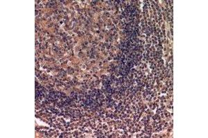 Immunohistochemical analysis of IDH3 alpha staining in human lymph gland formalin fixed paraffin embedded tissue section. (IDH3A 抗体)