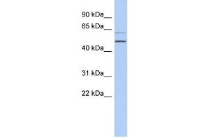 WB Suggested Anti-TBC1D10C Antibody Titration: 0. (Carabin 抗体  (N-Term))