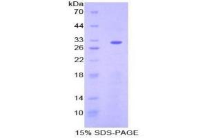 SDS-PAGE analysis of Mouse ENTPD1 Protein. (CD39 蛋白)