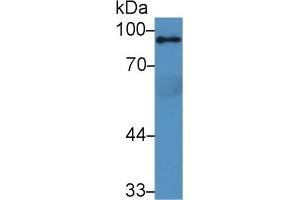 Detection of PPARgC1a in Rat Serum using Polyclonal Antibody to Peroxisome Proliferator Activated Receptor Gamma Coactivator 1 Alpha (PPARgC1a) (PPARGC1A 抗体  (AA 588-773))