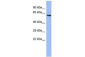 WB Suggested Anti-CYP4A22 Antibody Titration:  0. (CYP4A22 抗体  (N-Term))