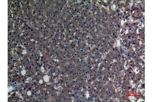 Immunohistochemistry (IHC) analysis of paraffin-embedded Human Liver, antibody was diluted at 1:100. (ALDH1A1 抗体  (N-Term))
