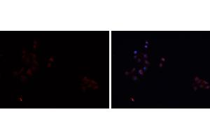 ABIN6276742 staining HEPG2 cells by IF/ICC. (SCARB1 抗体  (Internal Region))
