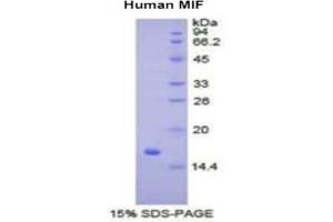 SDS-PAGE of Protein Standard from the Kit (Highly purified E. (MIF ELISA 试剂盒)