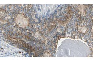 ABIN6274151 at 1/100 staining Human prostate tissue by IHC-P. (CKM 抗体  (N-Term))