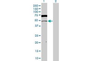 Western Blot analysis of CSNK2A1 expression in transfected 293T cell line by CSNK2A1 MaxPab polyclonal antibody. (CSNK2A1/CK II alpha 抗体  (AA 1-391))