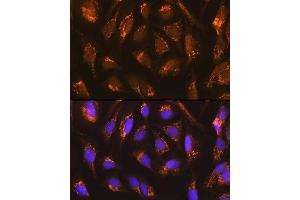 Immunofluorescence analysis of U-2 OS cells using TFAM Rabbit mAb (ABIN3023684, ABIN3023685, ABIN3023686, ABIN1680049 and ABIN1680050) at dilution of 1:100 (40x lens).