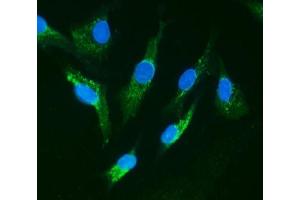 IF analysis of IRAK1 using anti-IRAK1 antibody (ABIN5693122). (IRAK1 抗体  (AA 377-479))